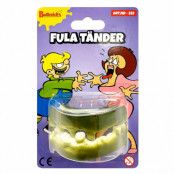 Löständer, fula tänder