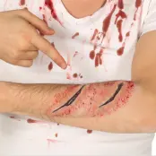 Latexsår 2st